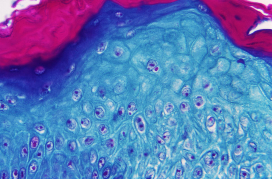 Imagen ampliada con un microscopio de una muestra de piel de un mono infectado con el virus de la viruela del mono. Nueve comunidades han detectado ya posibles casos sospechosos de viruela del mono, de la que ya hay 20 casos confirmados por el Ministerio de Sanidad y otros 16 están pendientes de resultados definitivos de secuenciación.