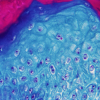 Imagen ampliada con un microscopio de una muestra de piel de un mono infectado con el virus de la viruela del mono. Nueve comunidades han detectado ya posibles casos sospechosos de viruela del mono, de la que ya hay 20 casos confirmados por el Ministerio de Sanidad y otros 16 están pendientes de resultados definitivos de secuenciación. 