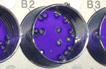 Análisis del virus COVID-19